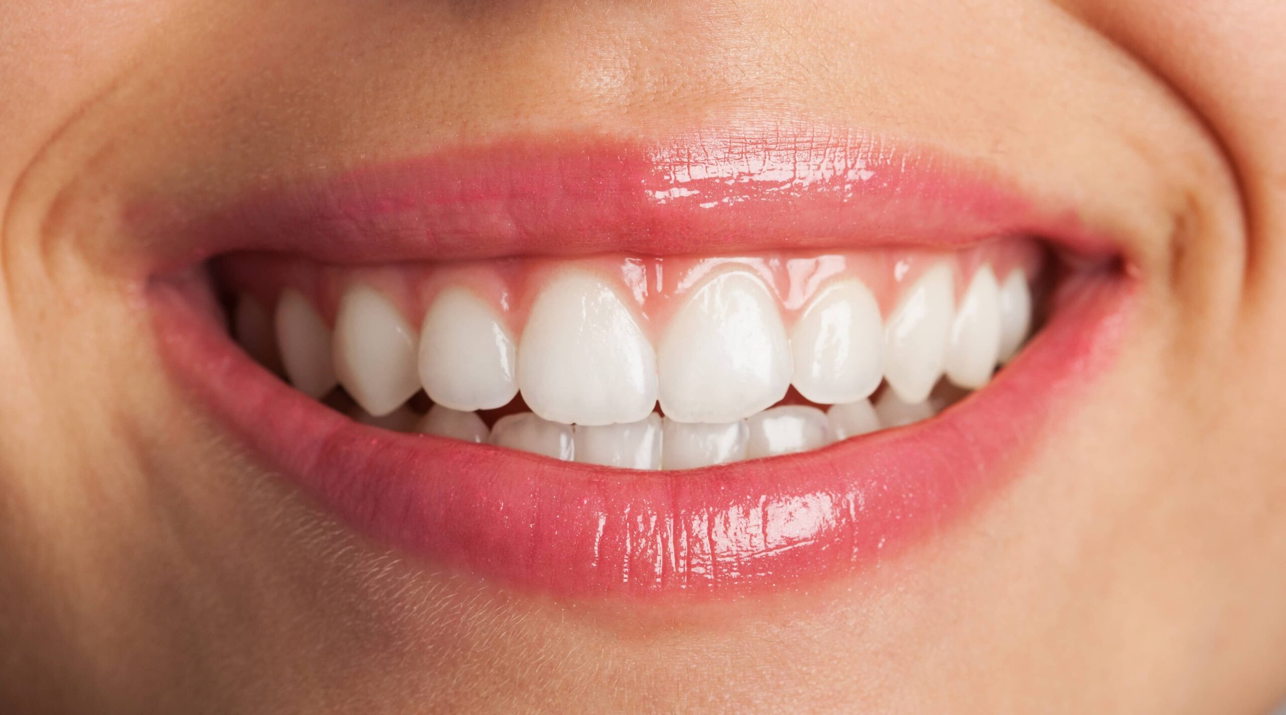 Close-up of a perfect smile — Smile Makeover at Calista Dental