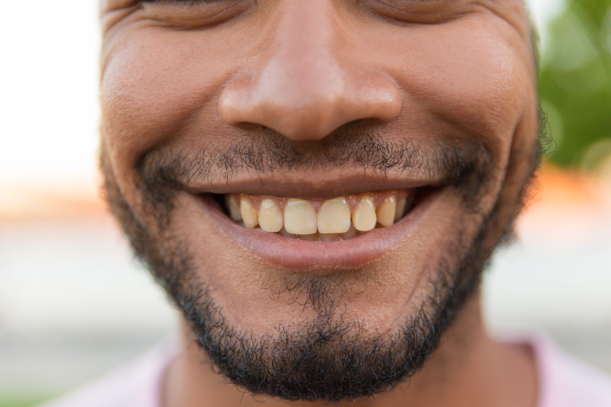 Bright confident smile after whitening treatment — Calista Dental