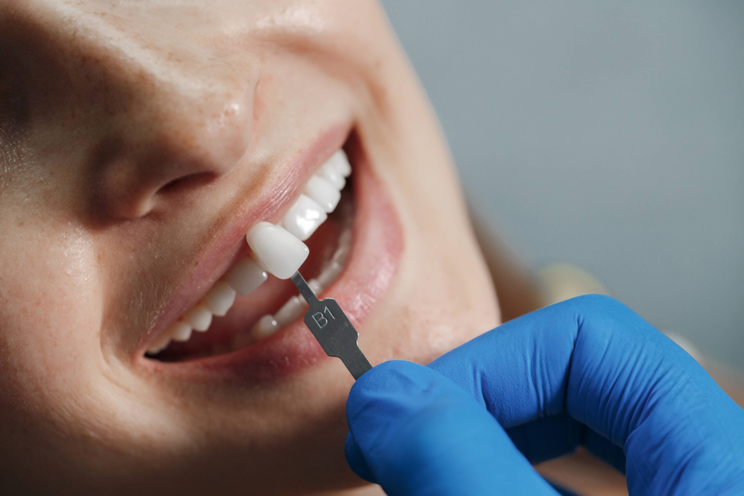 Dental implant treatment at Calista Dental, Mumbai