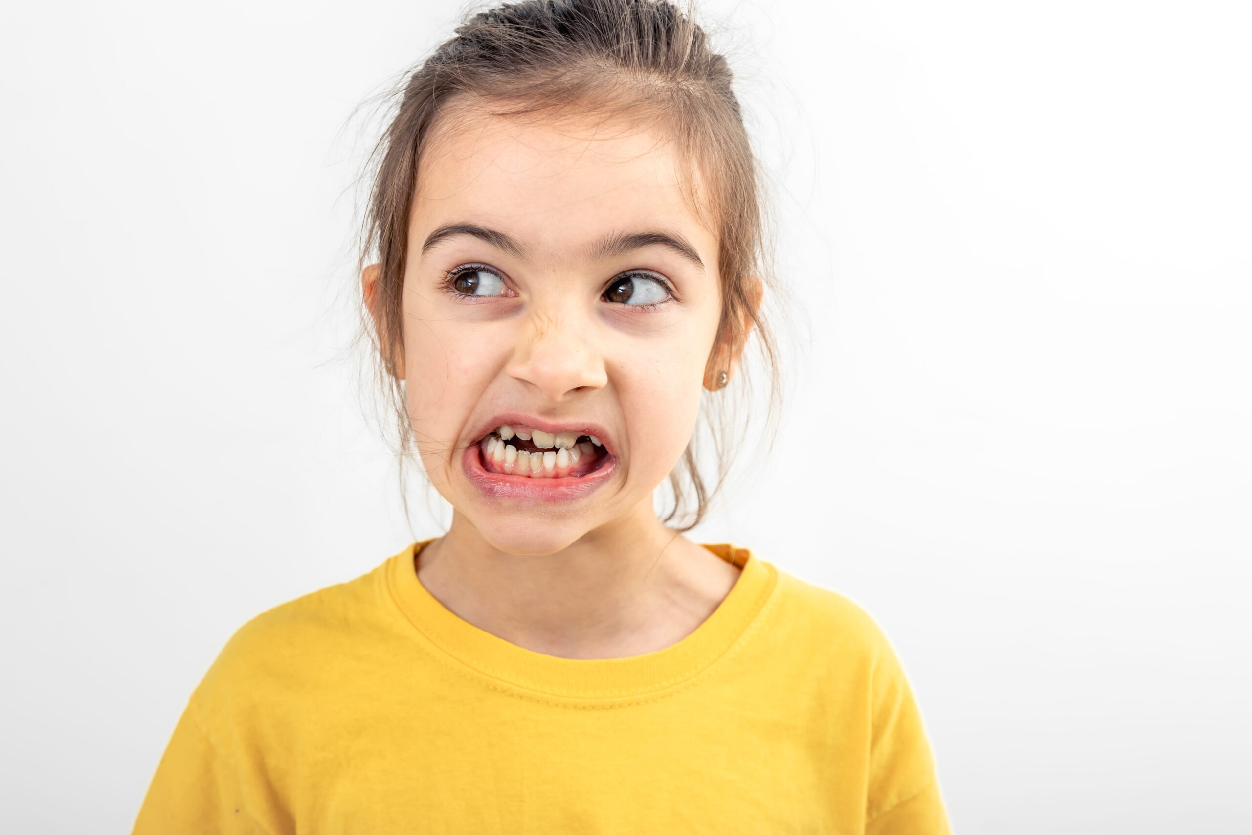 Chipped and cracked teeth treatment at Calista Dental
