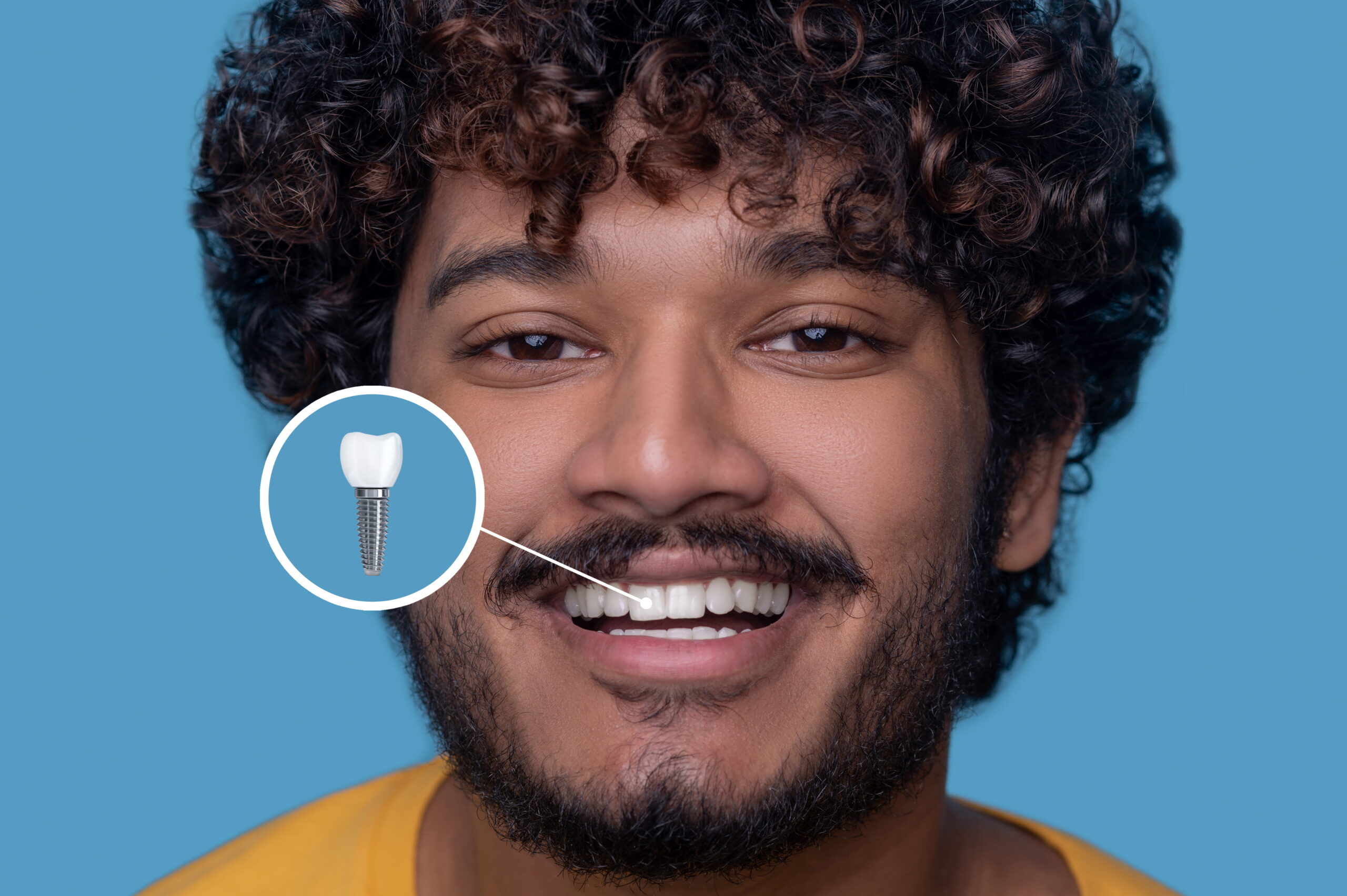 Man smiling and showing dental implant result — Calista Dental